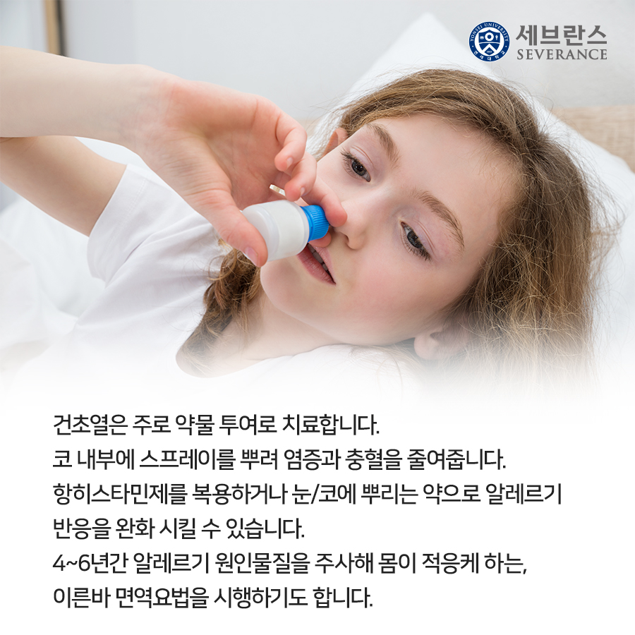 건초열은 주로 약물 투여로 치료합니다. 코 내부에 스프레이를 뿌려 염증과 충혈을 줄여줍니다. 항히스타민제를 복용하거나 눈/코에 뿌리는 약으로 알레르기 반응을 완화 시킬 수 있습니다.  4~6년간 알레르기 원인물질을 주사해 몸이 적응케 하는, 이른바 면역요법을 시행하기도 합니다. 